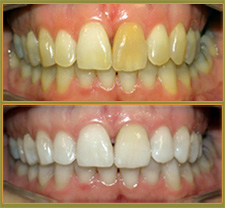 BEFORE & AFTER TREATMENT