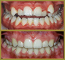 BEFORE & AFTER TREATMENT